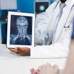 Mammography